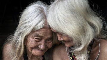 There Are Injections Available In China To Reverse Gray Hair